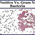 Distinction between Gram positive and Gram negative bacteria